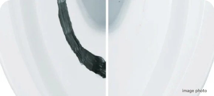 セフィオンテクト